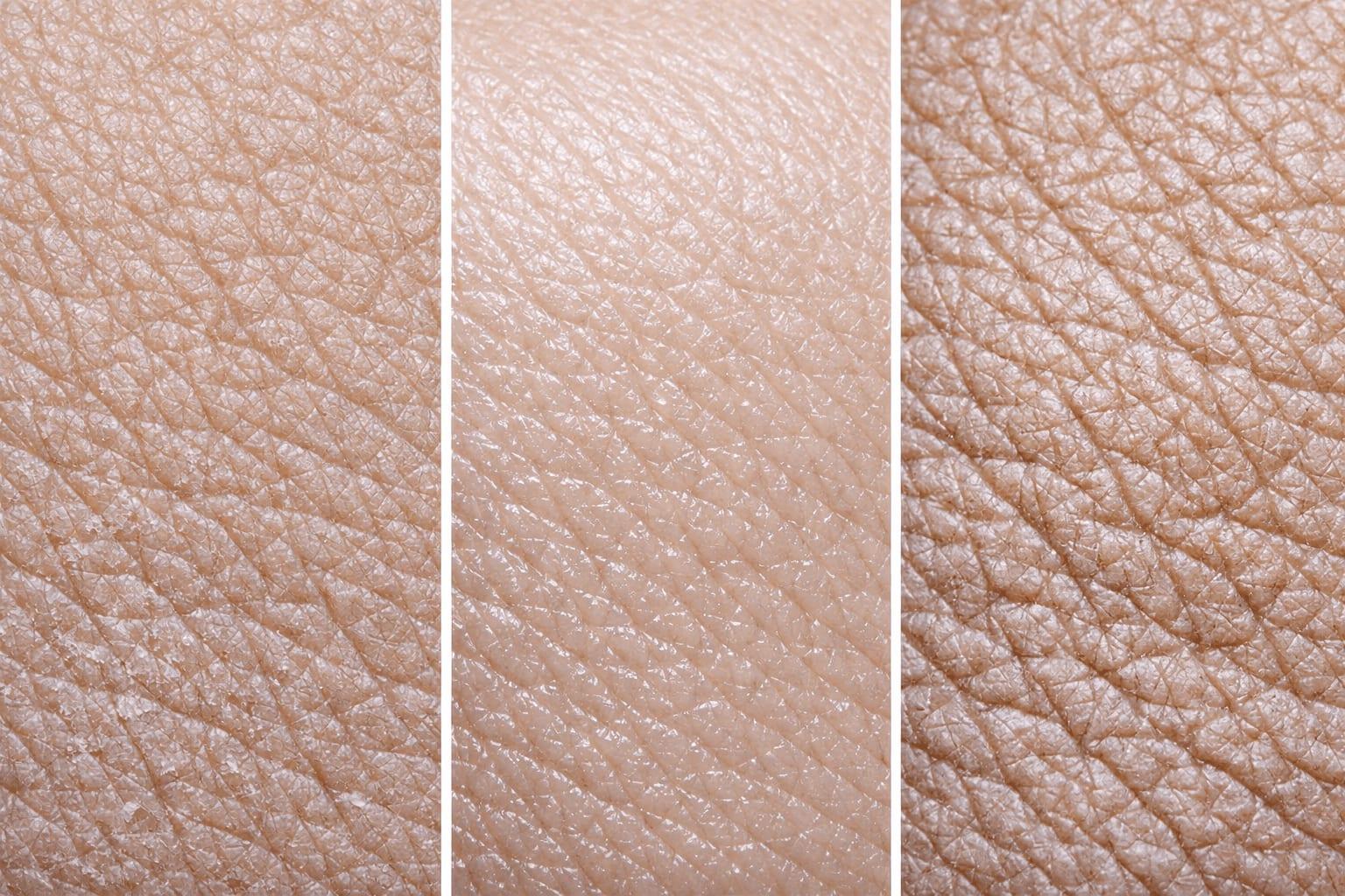 Close-up comparison of different skin textures showing menopausal skin changes