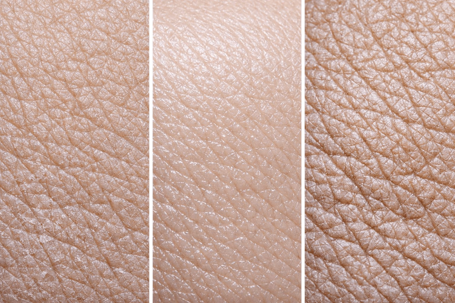 Close-up comparison of different skin textures showing menopausal skin changes