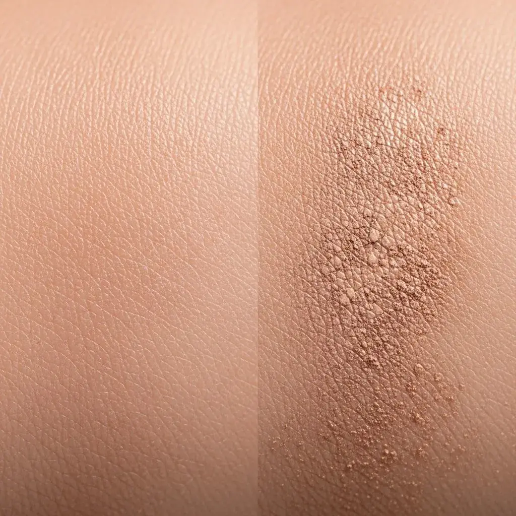 Comparison of comedogenic versus non-comedogenic setting spray formulas on acne-prone skin